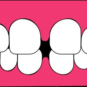 Až 95 % populace trápí záněty dásní.
