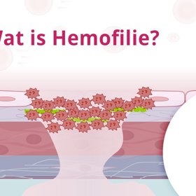 Co se děje při nemoci zvané hemofilie?