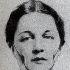 Chcete ďolíčky ve tváři? Není problém!