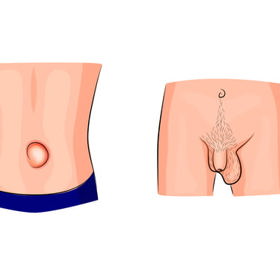 Kýla umí pěkně potrápit.