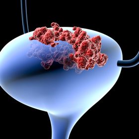 Rakovina prostaty je strašákem především mužů.