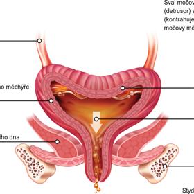 Močový měchýř může dost nepříjemně pozlobit.