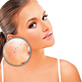 Kontrolujte si skvrny jak na viditelných, tak intimních partiích