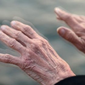 Parkinsonova choroba je degenerativní onemocnění nervového systému, typicky se projevuje klidovým třesem, ztuhlostí svalů, zpomalením pohybů a poruchami stoje a chůze.