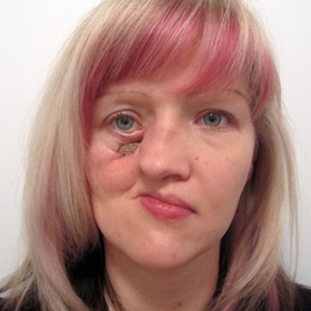 Mirce vzala rakovina část tváře, později se přidaly i další komplikace.