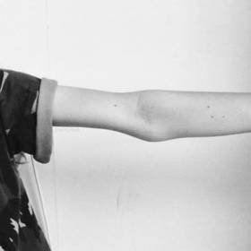 Pokud má vaše partnerka nebo dítě takovouhle ruku, řešte to s odborníkem