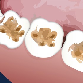 Čistěte zuby ze všech stran a zbavte je nevzhledných skvrn