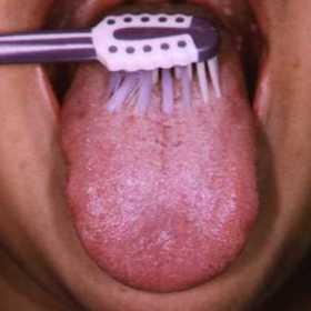 Diagnóza: Špatná ústní hygiena!