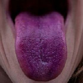 Diagnóza: Problémy s krevním oběhem.