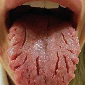 Diagnóza: Stárnutí!