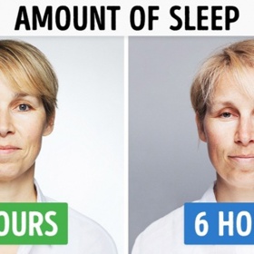 Tato fotografie jasně dokazuje, že nedostatek spánku se negativně podepisuje i na našem vzhledu.