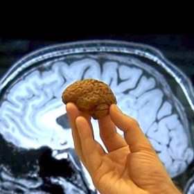 Samostatou zmínku si zaslouží i skutečnost, že čokoláda (především hořká) zlepšuje naše mentální schopnosti.