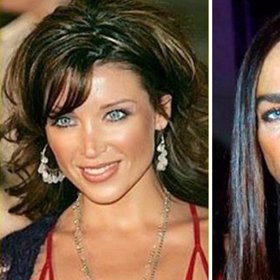 Kdysi krásná Michaela Romanini toužila po tváři bez vrásek a plných rtech.