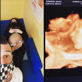 Holčička dostala jméno po slavné fotbalistce.