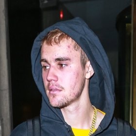 Nemohou za to drogy, ale drsná nemoc...