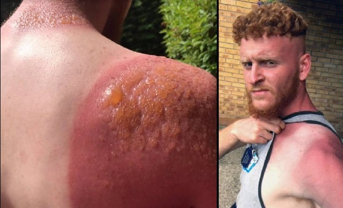 Foto k tématu Greg Binnie