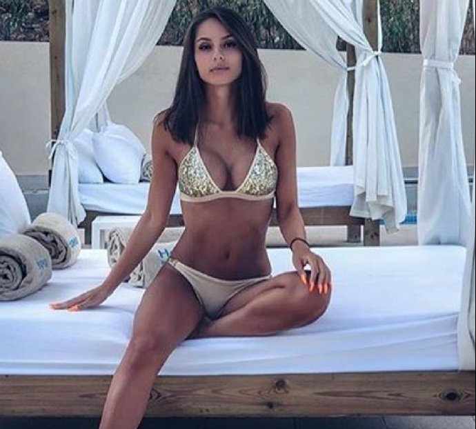 FOTO: Snad se jí popáleniny zahojí a Týnuš bude zase vypadat takhle. – stránka 361