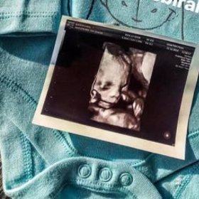 Petr Mikšíček očekává příchod potomka.