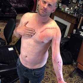 Záhadné tetování Jakuba.