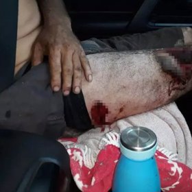 Chris McSherry musel podstoupit operaci.