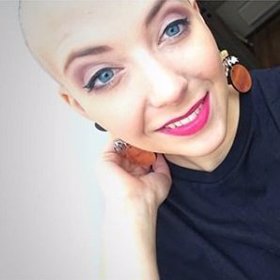 Anna Slováčková se pere s rakovinou