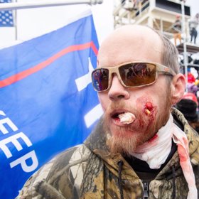 Jeden z příznivců Donalda Trumpa s prostřelenou tváří po potyčce u Kapitolu.