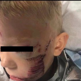 Chudáček. Snad se brzy uzdraví.