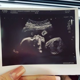 "Už teď jsi tolik milovaný, maličký," napsala Tammy Sutan k fotce.