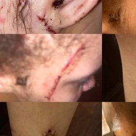 Zřejmě jí zůstanou ošklivé jizvy.