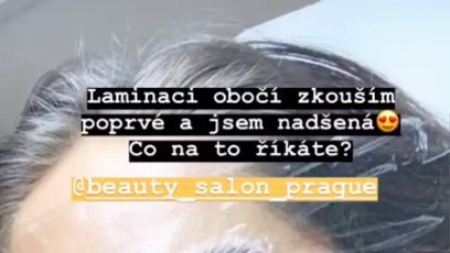 FOTO: Týnuš má velké jizvy na obličeji.