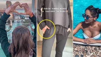 FOTO: Vypadá to, že se jí rány dobře hojí...