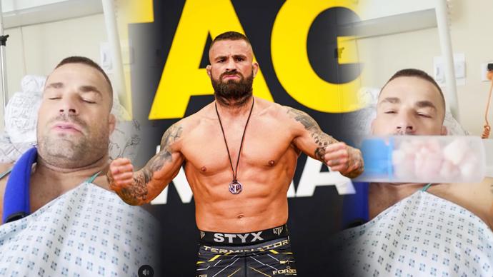 FOTO: Karlos Vémola po operaci lokte. – stránka 1850