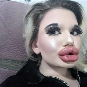 Andrea Ivanova je bulharská studentka, která chce mít největší rty na světě.