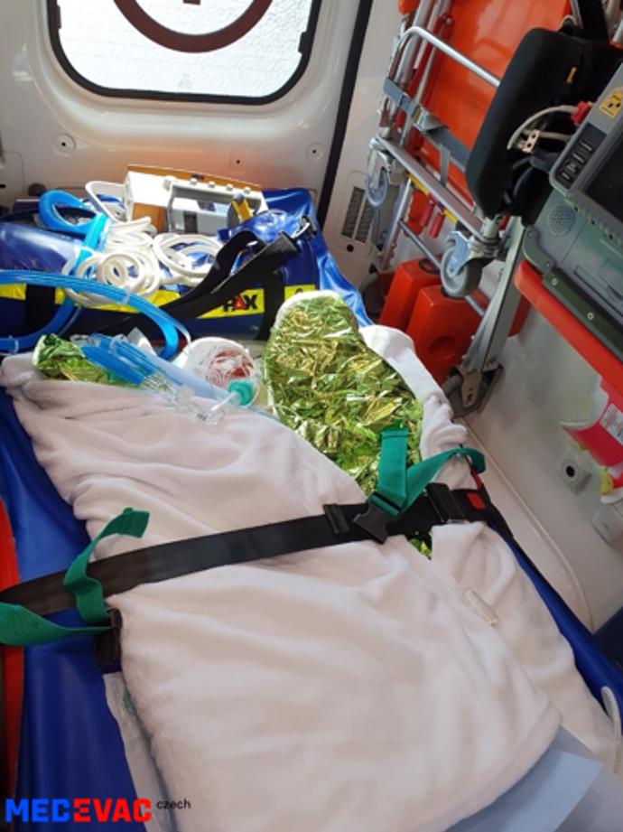 FOTO: Popálená ukrajinská holčička. – stránka 1225