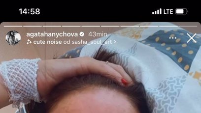 FOTO: Agáta v nemocnici.