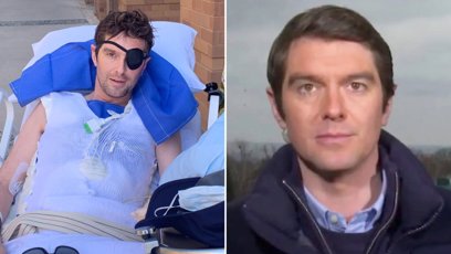 FOTO: Britský novinář Benjamin Hall byl vážně zraněn na Ukrajině.