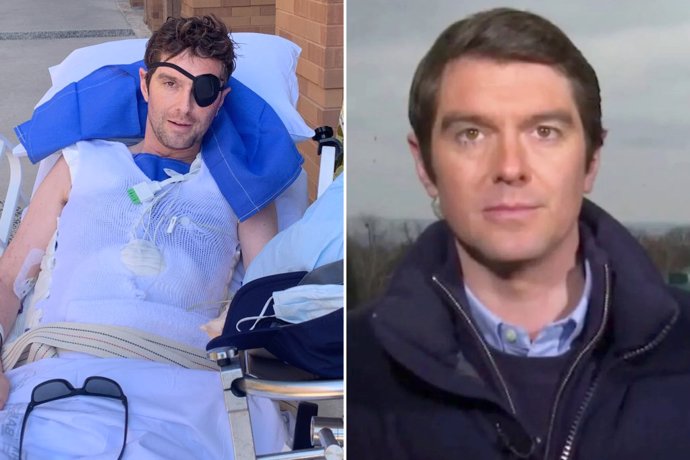 FOTO: Britský novinář Benjamin Hall byl vážně zraněn na Ukrajině. – stránka 1113