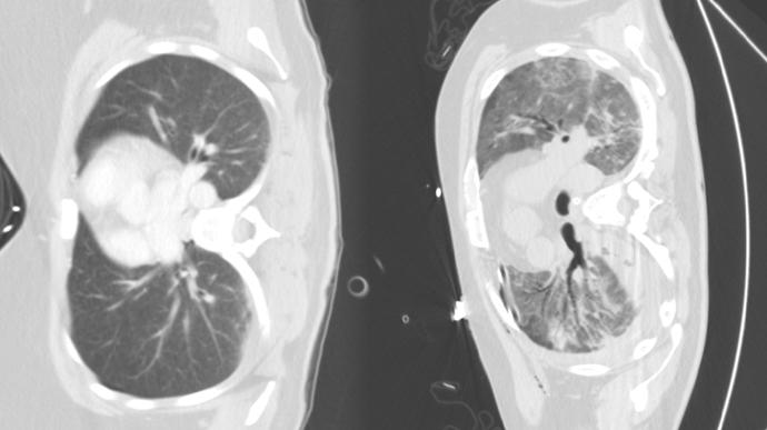 Foto k tématu plíce – stránka 2