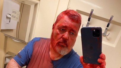 FOTO: Šéfredaktor nezávislého ruského listu Novaja gazeta a držitel Nobelovy ceny míru Dmitrij Muratov byl napaden při cestě ve vlaku.