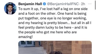 FOTO: Anglický novinář přišel během bojů na Ukrajině o nohu.