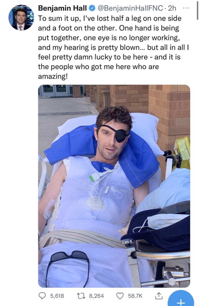 FOTO: Anglický novinář přišel během bojů na Ukrajině o nohu. – stránka 1125