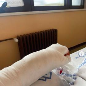 Jaromír Soukup po operaci zlomené ruky. 