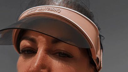 FOTO: Agáta plánuje botox i operaci očních víček.