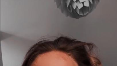 FOTO: Agáta přiznala, že si nechala napíchat rty.