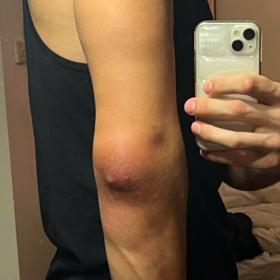 Musel podstoupit zákrok a odstoupit ze zápasu