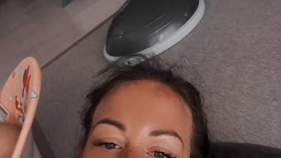 FOTO: Agáta podstoupila výplň rtů a botox