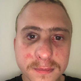 Zničili mu navíc naslouchátko, které je pro něj velmi důležité