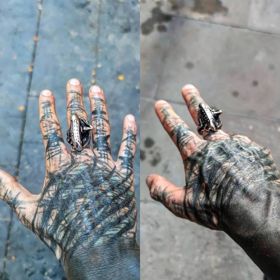 Anthony si nechal amputoval pár prstů.