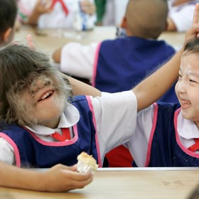 Supatra v době, kdy chodila do školky