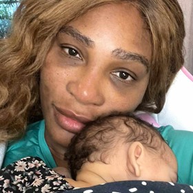 V srpnu porodila mladší dceru Adiru, a když se nedávno spálila pod očima, aplikovala na podrážděná místa mateřské mléko.